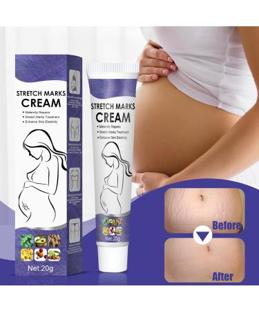 Bploar 2 Pieces Stretch Mark Cream Anti Stretch Mark Cream Stretch Mark Repair Cream Gentle Moisturizing Cream for Stretch Mark Prevention and Treatment 1 - Buy Online on GoSupps.com