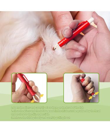 Starfa Lab Tick Removal Tool Kit - 5PC Set for Dogs Cats & Humans | 3 Tick Hooks & 2 Tweezers | International Shipping Available - Buy Online on GoSupps.com