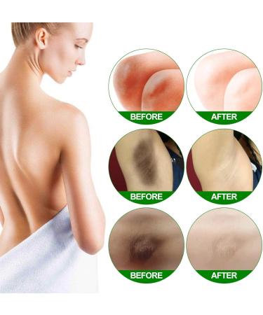  J TOHLO Natural Whitening Body Cream Whitening Cream for Underarms Knees Elbows Sensitive and Private White Areas Nourishes Repairs & Restores Skin 50ml - Buy Online on GoSupps.com