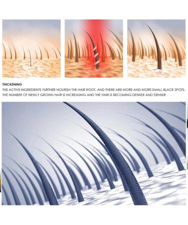 EXQST Suki-Bay Rice Water Advanced Serum Rice Water Hair Serum Hair Oil for Dry Damaged Hair and Growth - Buy Online on GoSupps.com