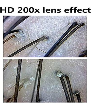 Generic Professional Skin Hair Analyzer 9 Inch Display Screen HD Scalp Detection Hair Follicle Analyzer Digital Scalp Hair Follicle Tester Hair Analysis Scanner for Home Business Beauty Salon - Buy Online on GoSupps.com