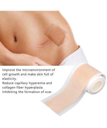 Silicone Scar Removal Tape Roll - Reusable Self-Adhesive Sheets for Hyperplastic, Burn, Keloid Scars - 59.1in - Buy Online on GoSupps.com