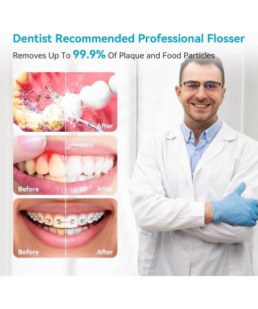 Buy Cordless Water Dental Flosser - Rechargeable Oral Irrigator for Home & Travel | Effective Teeth & Braces Care - Buy Online on GoSupps.com
