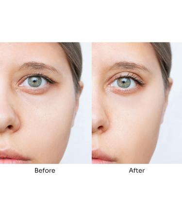 Vemoerce Invisible Eyelid Tape 400Pcs - Instant Eye Lift Strips for Hooded Eyes - Comfortable and Skin-Friendly - Easy Application - Buy Online on GoSupps.com