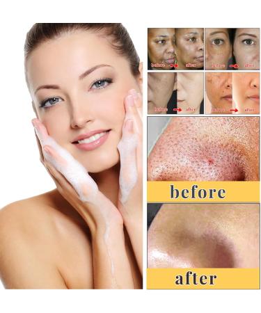  MEITREND Kojic Lightening Kojic Acid Soap for Dark Spots Acne and Blackheads Kojic Acid Soap for Face and Body Deep Cleansing for All Types of - Buy Online on GoSupps.com