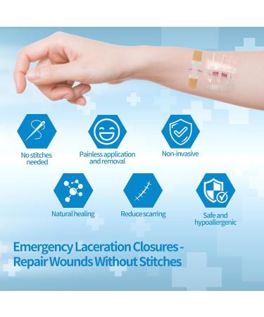 Emergency Laceration Closures - Zipstitch Wound Closure Device (4 Set) | Easy Use No Stitches Ideal for Home & Outdoors - Buy Online on GoSupps.com