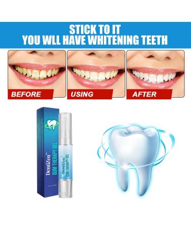 Dentiz Gums Therapy Gel & Tooth Whitening Set - 5-Piece Stain Remover for Sensitive Teeth - Buy Online on GoSupps.com