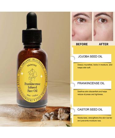 2pcs Frankincense Resin Oil Frankincense Infused Face Oil Infused With Organic Black Seed Castor And Jojoba Oil Facial Moisturizing Anti-Aging Serum - Buy Online on GoSupps.com