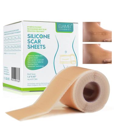 Silicone Scar Sheets Soft Silicone Scar Tape(4CM 150CM) Medical Grade Scar Strips Effective Scar Removal Sheets Waterproof Reusable for Burn Keloid C Section Surgery Acne Tummy Tuck