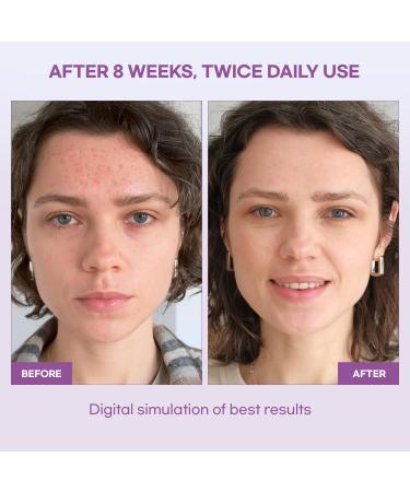 Natural Vine Dark Spot Serum: Dark Spot Remover for Face with Grape Extract Fermentation Complex Hyaluronic Acid & Vitamin E 1 FL OZ / 30mL 1 Fl Oz (Pack of 1) - Buy Online on GoSupps.com