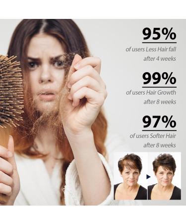 S rum de Croissance de Cheveux S rum de Croissance des Cheveux Naturel pour Cheveuxs Acc l rer la Croissance des Cheveuxs pr venir la chute des - Buy Online on GoSupps.com