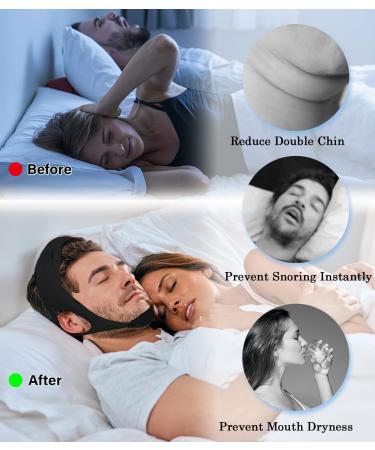 Anti Snore Chin Strap Device for CPAP Users | Adjustable Snoring Head Band | Breathable Mouth Closure - Gray-M - Buy Online on GoSupps.com