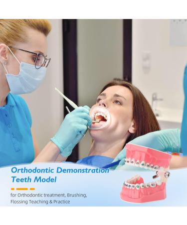 Buy Dental Demonstration Orthodontic Model with Metal Wires & Bracket - Ideal for Teaching Brushing & Flossing Practices - Buy Online on GoSupps.com