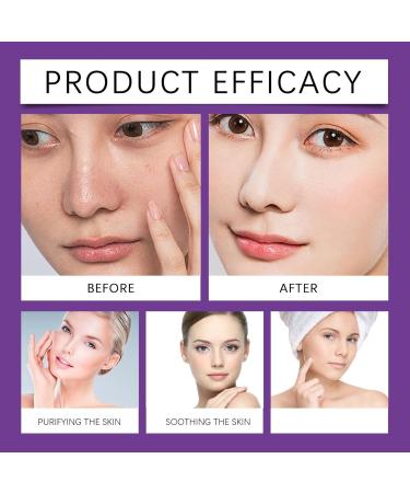 Dark Spot Correcting Glow Serum Dark Spot Repair Essence Lotion - Brightening & Moisturizing Korean Skincare Anti-Hyperpigmentation Treatment Anti-Aging Fine Lines & Circles - Buy Online on GoSupps.com