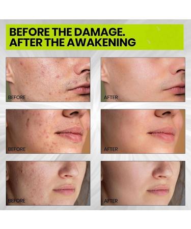 G n rique Moisturizer Face Cream Natural Hydrating Facial Lotion Soothing Repair Formula Gentle for Dry and Damaged Skin Neck Day and Night Use Skin Care - Buy Online on GoSupps.com