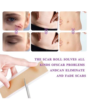 Medical Grade Silicone Scar Sheets - 1.6 x 60 Reusable Gel Tape for Acne, C-Section, Keloid Surgery Scars Treatment - Buy Online on GoSupps.com