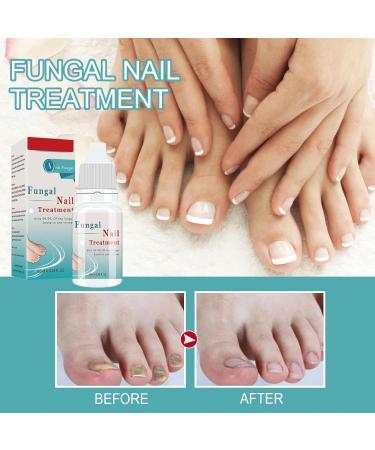 3pcs Onyxoguard Nail Growth And Repair Serum Nail Growth And Strengthening Oil - Buy Online on GoSupps.com