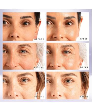 Face Moisturizer for Women - Anti Wrinkle Face Cream - Moisturiser Face Women - 4 in 1 Face Cream - Hyaluronic Acid Ingreients - Deeply Nourishes Skin - Skin Lightening Cream - Buy Online on GoSupps.com