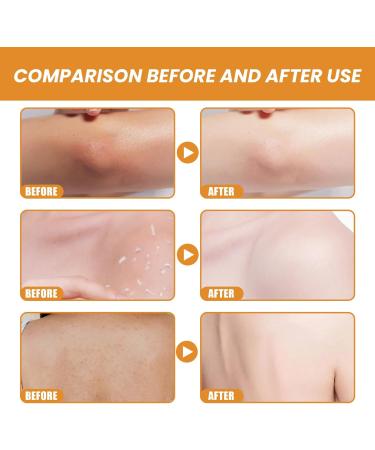 Citrus Vitamin C Exfoliating Gel Deep Cleaning Skin Exfoliator Fight Dullness Face Wash Moisturizing Natural Smoothing Soften Face Scrub Exfoliator Skin Tone Improving Exfoliator For All Skin Types - Buy Online on GoSupps.com
