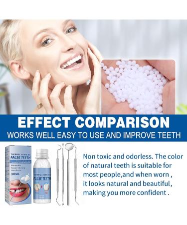 Allony Temporary Dentures & Tooth Repair Kit | Durable Dental Care for Broken Teeth - International Shipping Available - Buy Online on GoSupps.com