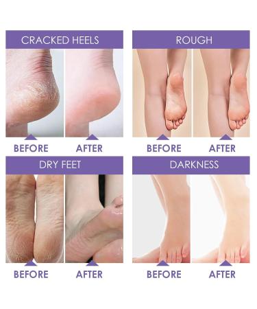 Exfoliating Foot Mask - 2 Pairs of Lavender & Roses Cornea Socks for Effective Foot Care | Unisex Dead Skin Remover - Buy Online on GoSupps.com