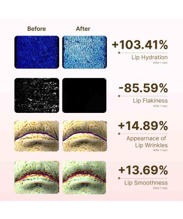 beenuvo Honey & Collagen Lip Butter Hydrating Lip Treatment Overnight Lip Mask Moisturizing Lip Balm with Jojoba Oil & Squalane Lip Care Korean Skin Care (0.45 oz) - Buy Online on GoSupps.com