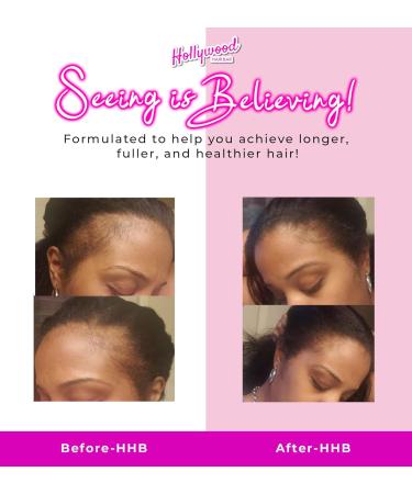 Hollywood Hair Bar Super Grow Scalp Balm - Revitalizing Vegan Scalp Treatment | 4 oz - Cruelty-Free Hair Care for Healthy Growth - Buy Online on GoSupps.com