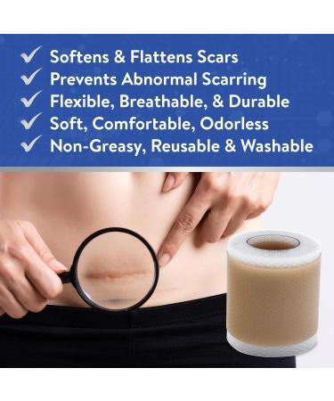 Retailio Silicone Scar Sheets - Soften, Flatten Scars, C-Section, Keloid Surgery - Reusable, Washable - 1.6x60 - Buy Online on GoSupps.com
