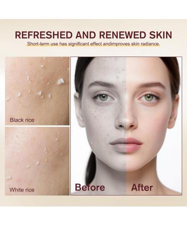 Peel Shot Glow Rice Ampoule Duo | Black Rice Exfoliant | Exfoliating Serum with Rice Enzymes & Minimize Pores Refine Skin Texture & Target Blackheads. For All Skin Types 3.38 Fl Oz (Pack of 2) - Buy Online on GoSupps.com