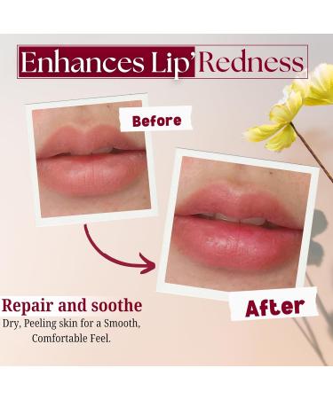 Merlena Pink Lip & Nip Serum - Hydrates and Repairs Dry Peeling Lips and Nipples Adds Collagen for Plumpness Soothes Flaky Skin Organic Vitamin C & E Formula 8ml - Buy Online on GoSupps.com