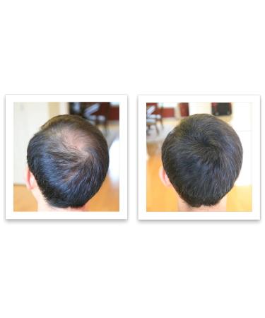 Caboki 10X Volumizing Hair Powder - Talc-Free Dark Gray | Root Touch Up for Thinning Hair | Cover Bald Spots for Men & Women - Buy Online on GoSupps.com