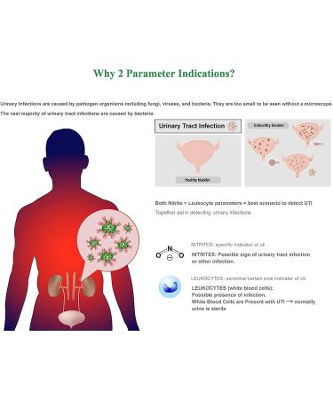 EasyHome 25 Urinary Tract FSA Eligible UTI Test Strips - FDA Cleared OTC Urine Test - Monitor Bladder Health - Urinalysis (UTI-25P) 25 Count - Buy Online on GoSupps.com