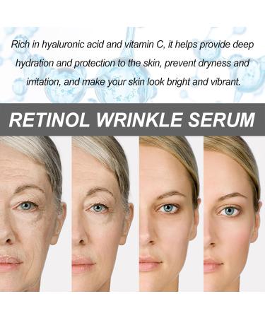 Retinol Serum for Face 37ml - 0.4% Japan Retinol Serum High Strength for Face with Vitamin C Hyaluronic Acid Anti Aging Face Serum for Women Acne Scar Dark Spot Fine Line and Wrinkles - Buy Online on GoSupps.com