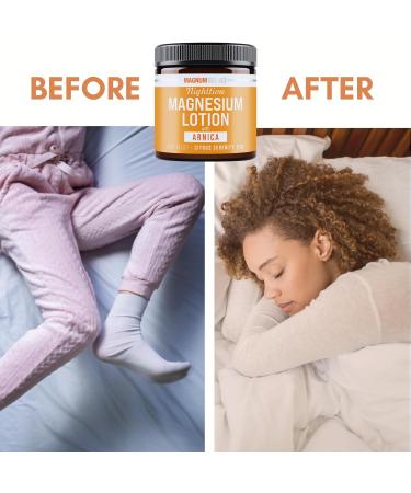 Magnum Solace Nighttime Magnesium Lotion with Arnica Soothing Relief & Relaxation Highly Concentrated Magnesium for Muscles & Joints Apply to Legs or Feet Before Bed Skin-Friendly - Buy Online on GoSupps.com