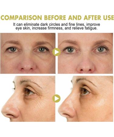 Snail Peptide Eye Cream Stick 3g Reduce Dark Circles Puffiness Firming Brightening Anti-Aging Nourishing Moisturizing (1PCS) - Buy Online on GoSupps.com