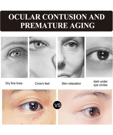  Grgowe 2Pack Retinol Moisturizing Cream The Ordinary Retinol Face Serum Retinol Essence Anti Aging Wrinkle Removal Skin Firming Cream Reduces Dry Wrinkles And Fine Lines - Buy Online on GoSupps.com