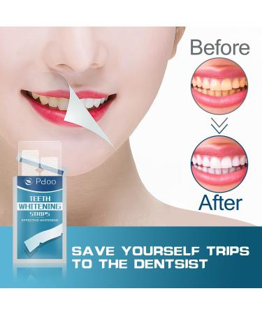 Bande Blanchiment Dentaire 28 Bandes - Blanchiment Dentaire sans Peroxyde - sans Sensibilit la Douleur - Whitening Strips Efficace limine Taches Caf /Th /Vin R sultats Visibles Rapidement Sans saveur 1 unit (Lot de 28) - Buy Online on GoSupps.com