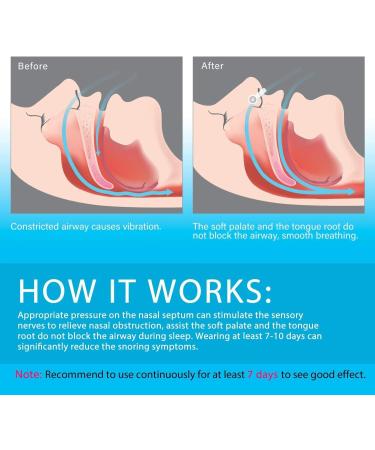 Vicorrect Anti Snoring Devices - 4 Magnetic Nose Clips with 4 Nasal Dilators - Snore Stopper for Deep Sleep - Buy Online on GoSupps.com