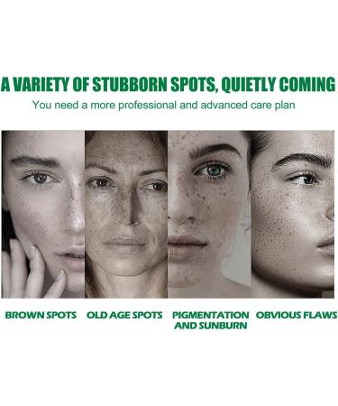 Nuvilo Dark Spot Correcting Glow Serum with niacinamide facial serum against dark spots brightening care for hyperpigmentation moisturizing antiaging skin care 1 piece 1 piece - Buy Online on GoSupps.com