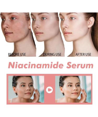Peach 70% Niacinamide Serum Face Daily Clean Beauty Moisturising Skin Brightening Hydrating Face Serum Niacinamide Serum For Face Face Serum For Skin Care Dark Spot Remover For Face Serums Skincare - Buy Online on GoSupps.com