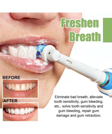  REPWEY 2 x TLOPA Toothpaste Bulbs Tooth Serum 3 V Fruit Acid Teeth Whitening Essence Stain Remover for Teeth - Buy Online on GoSupps.com