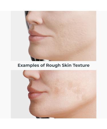 NassifMD Even Correct & Renew Retexturizing Pads | Chemical Peel & Skin Resurfacing for Post-Acne Marks | Hyperpigmentation & Pore Minimizer Treatment Shop Internationally - Buy Online on GoSupps.com
