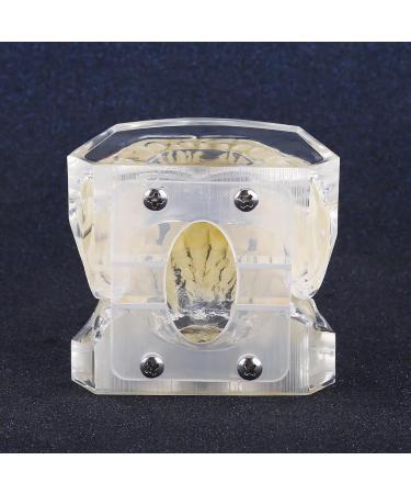 Buy BigKing Orthodontic Model - Dental Malocclusion Study Tooth Model with Wire Chain for Orthodontic Treatment - International Shipping Available - Buy Online on GoSupps.com