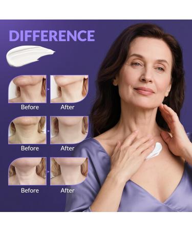 Neck Cream for Tightening and Firming Fast-Absorbing Anti-Aging Neck & Face Cream with Collagen & Peptides Visible Results in Days Daily Moisturizing for Neck Face & Chest 1.7 Fl Oz 1.7 Fl Oz (Pack of 1) - Buy Online on GoSupps.com