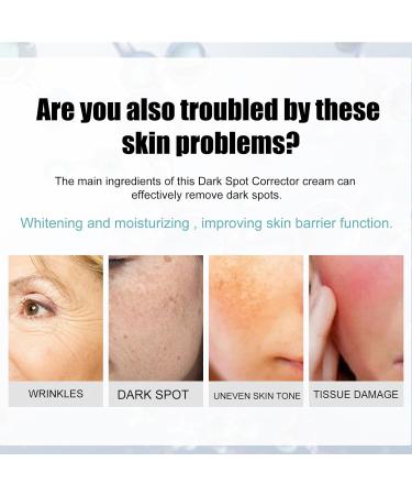 KOAHDE Black Spot Removing Cream Whitening and Freckle Removing Face Cream Spot Lightening Face Cream Dark Spot Corrector Creams Dark Spot Removing Moisture Cream Spot Skin Repairing Face Cream - Buy Online on GoSupps.com