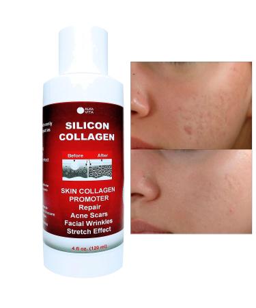 ALKA VITA Silicon & Collagen Gel for Indented Facial Scars - Skin Resurfacing & Collagen Promotion - Buy Online on GoSupps.com