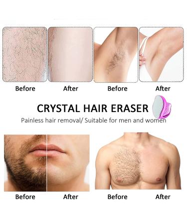 Crystal Hair Eraser: Upgraded Painless Exfoliation Hair Remover for Women and Men - Reusable & Washable (Rose) - Buy Online on GoSupps.com
