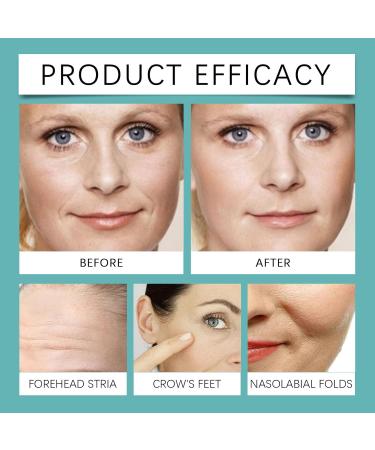 homomdy Moisturizing AntiAging Facial Serum for Women Deeply Hydrates Reduces Fine Lines and Wrinkles Reduces Dull Skin Fades Dark Spots Brightens Complexion 1pcs - Buy Online on GoSupps.com