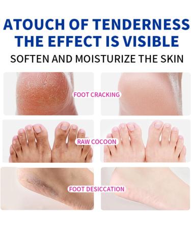 45% Urea Foot Cream Cracked Heel Repair Cream Foot Nourishing Cream Foot Moisturizer Foot Cream for Cracked Heels and Dry Skin Hard Skin Remover Foot Cream Urea Cream Foot Moisturiser 50g - Buy Online on GoSupps.com