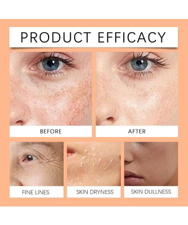 Daily Hydration Face Cream - Lightweight Moisturizer For Glowing Skin Nourishes & Improves Texture Locks In Moisture - Buy Online on GoSupps.com